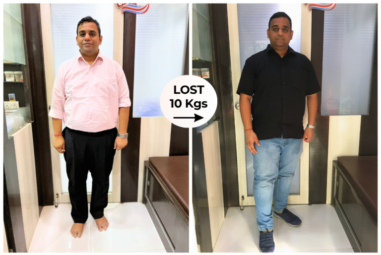 Weight Loss Journey of 10kgs