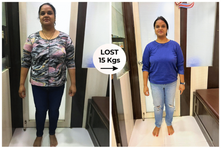 Weight Loss Journey of 15kgs